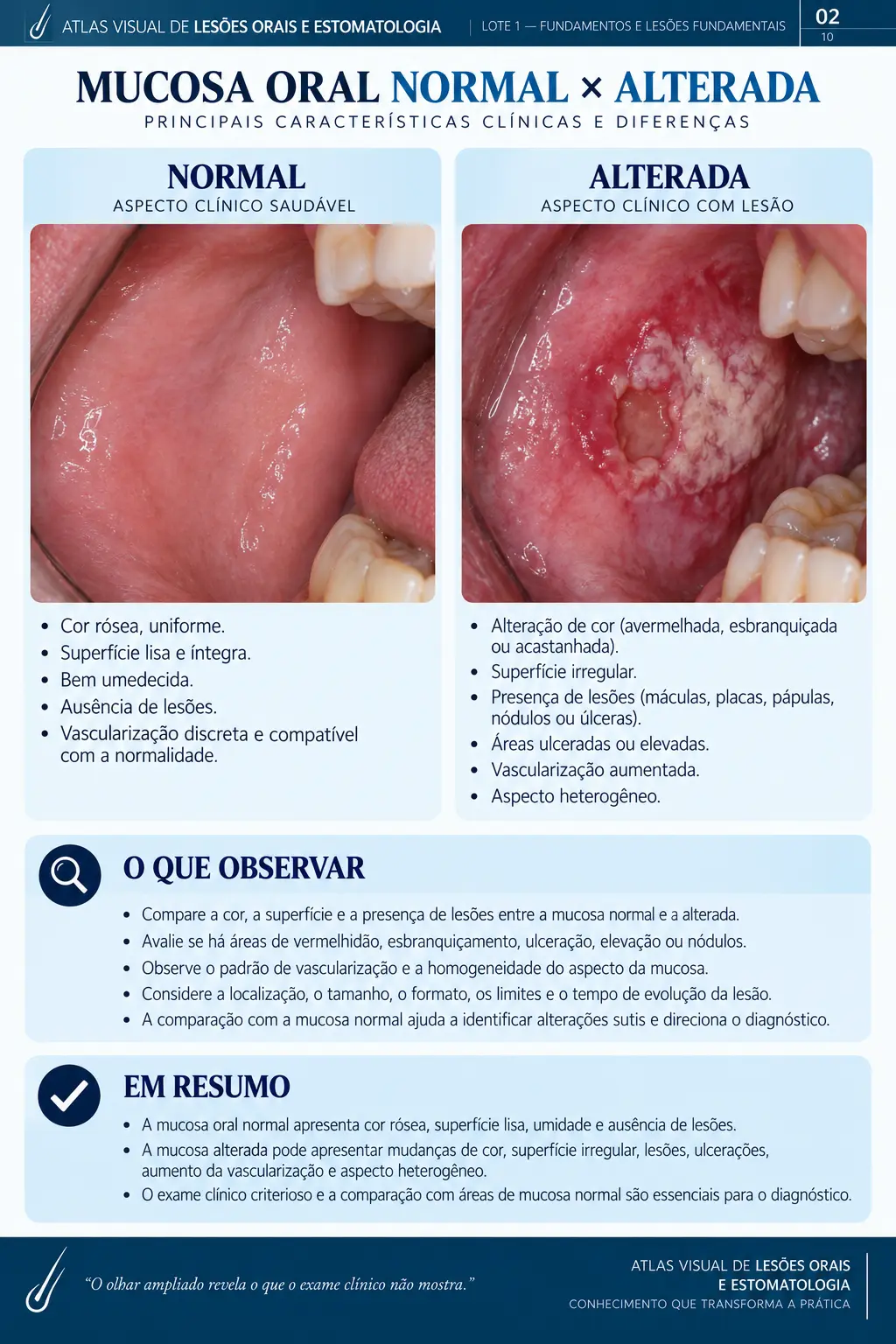 Página do ORALMAP: Leucoplasia × Líquen Plano Oral