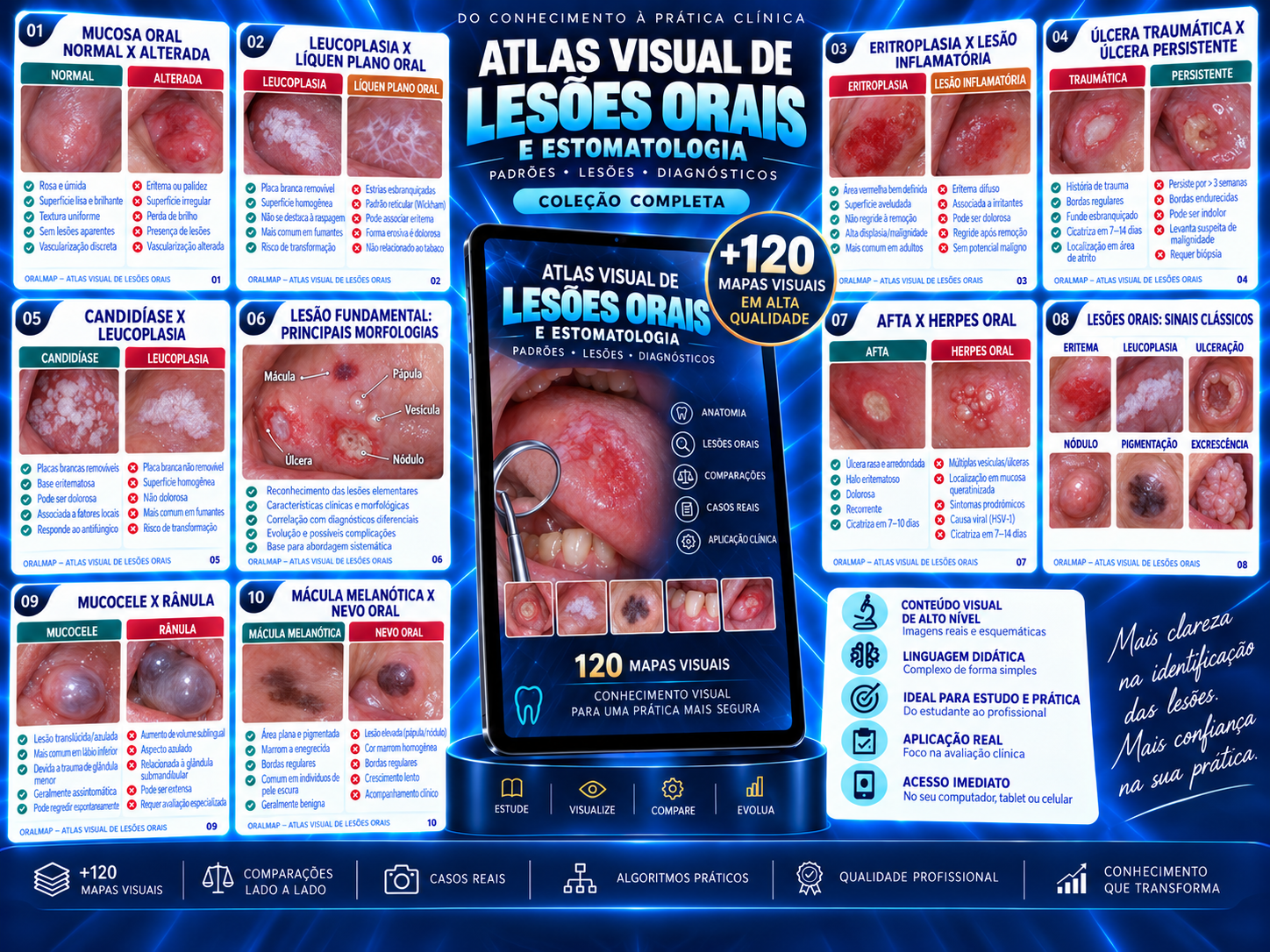 ORALMAP — Coleção completa: Atlas Visual de Lesões Orais e Estomatologia