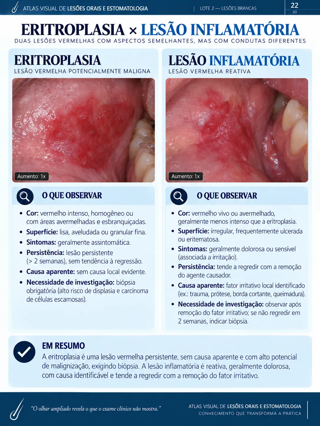 Página do ORALMAP: Eritroplasia