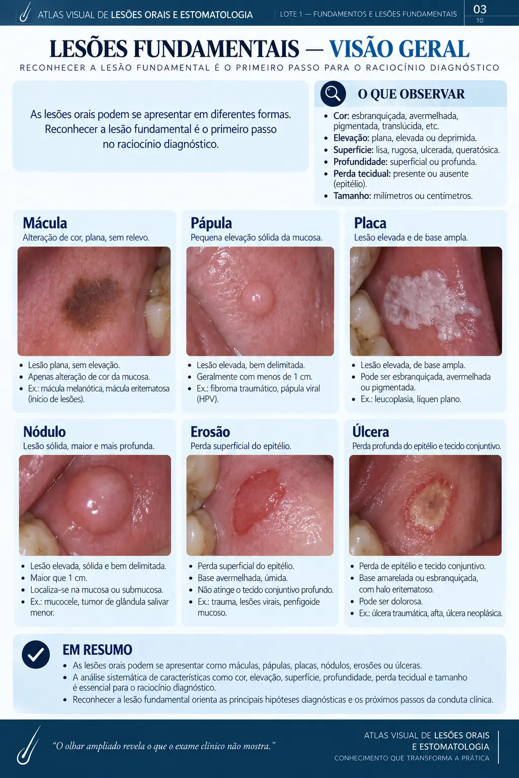 Página do ORALMAP: Eritroplasia × Lesão Inflamatória