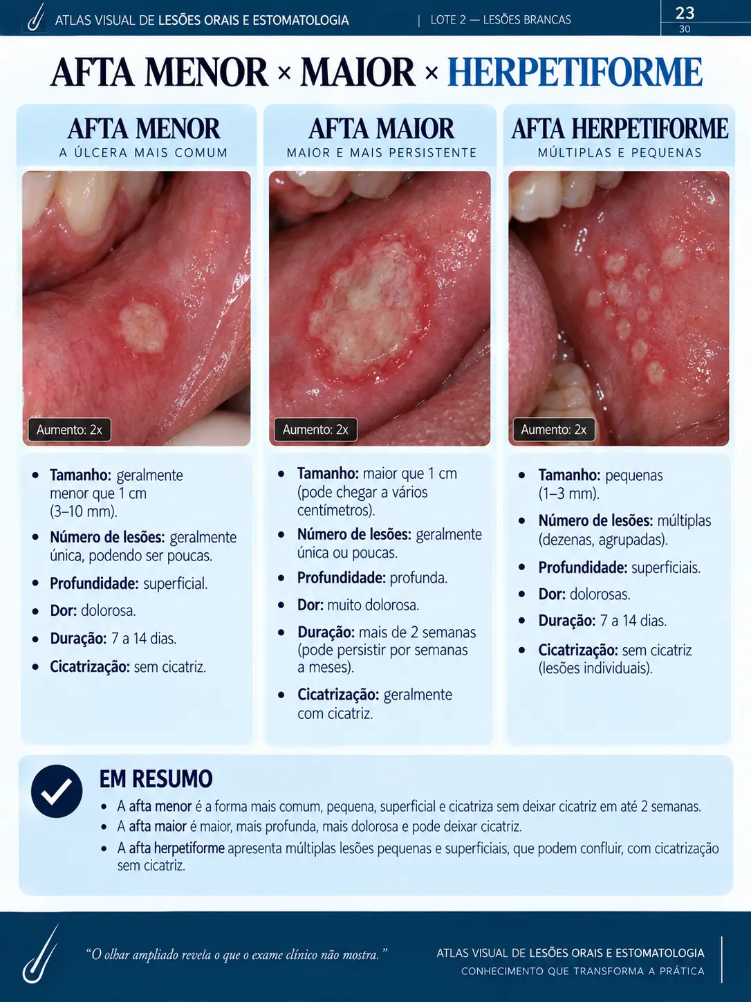 Página do ORALMAP: Líquen Plano Oral