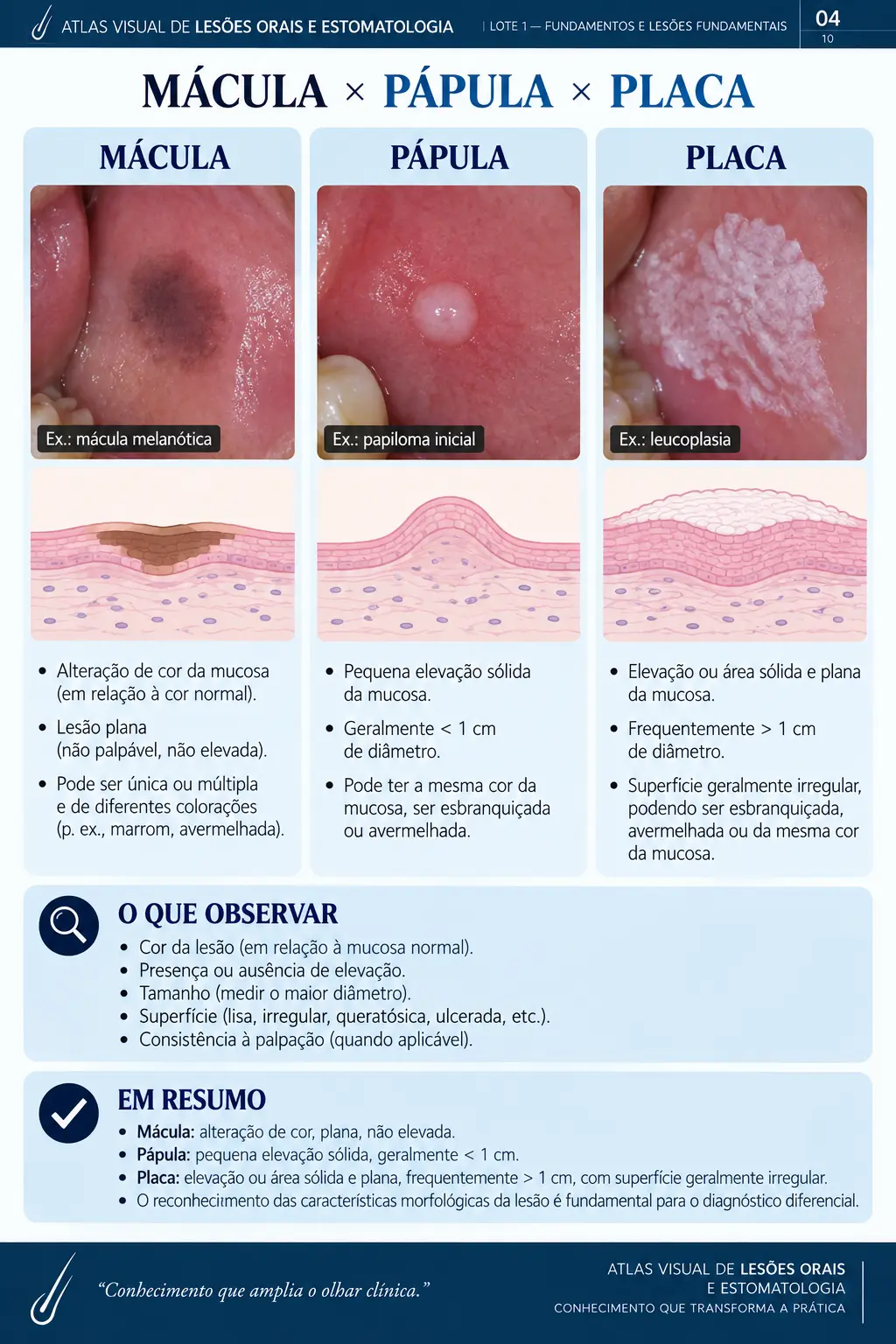 Página do ORALMAP: Úlcera Traumática × Úlcera Persistente
