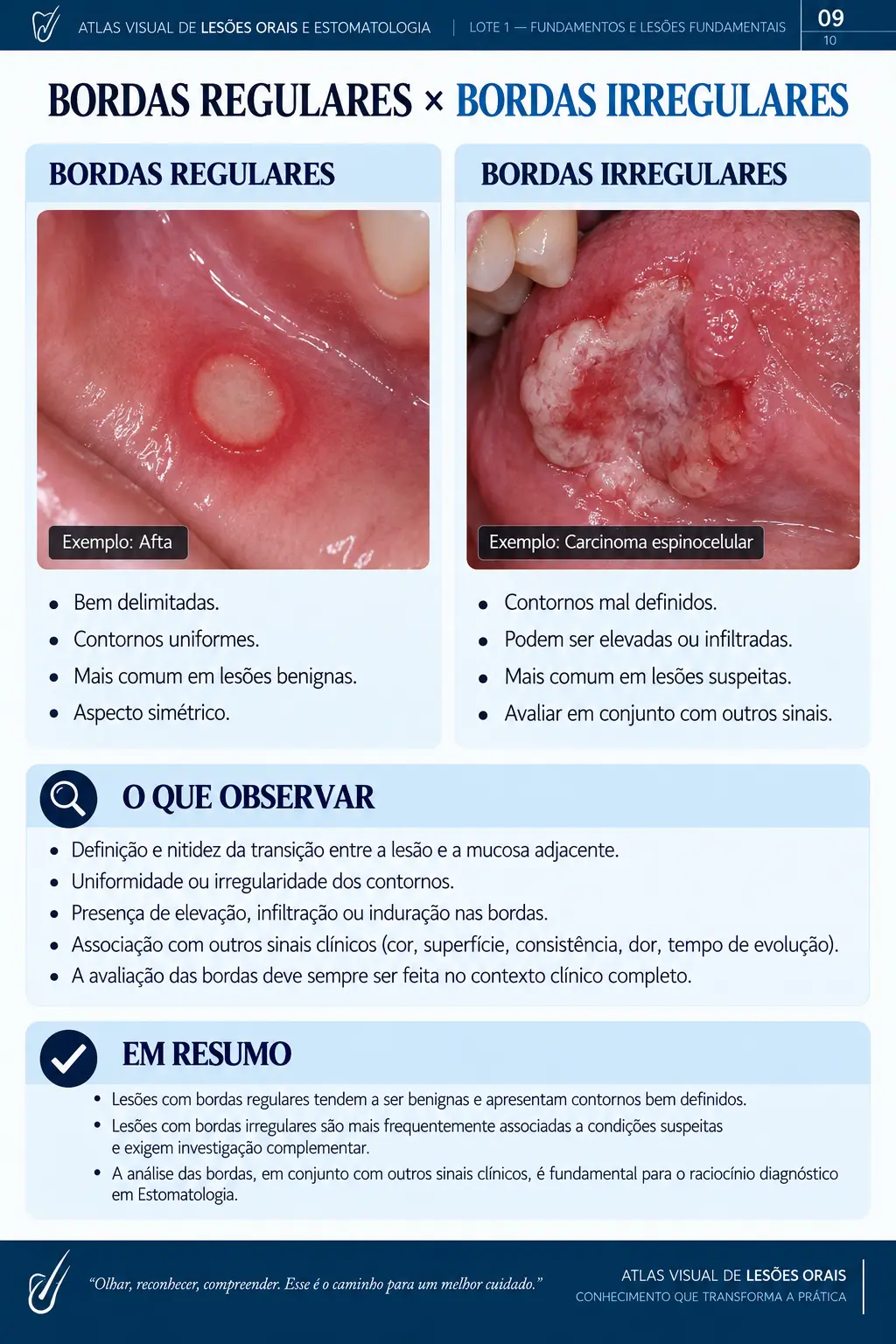 Página do ORALMAP: Mácula Melanótica × Nevo Oral