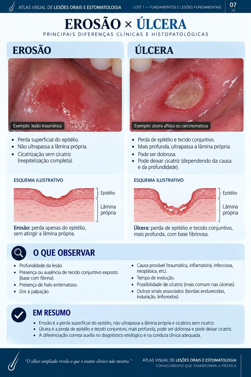 Página do ORALMAP: Mucocele × Rânula