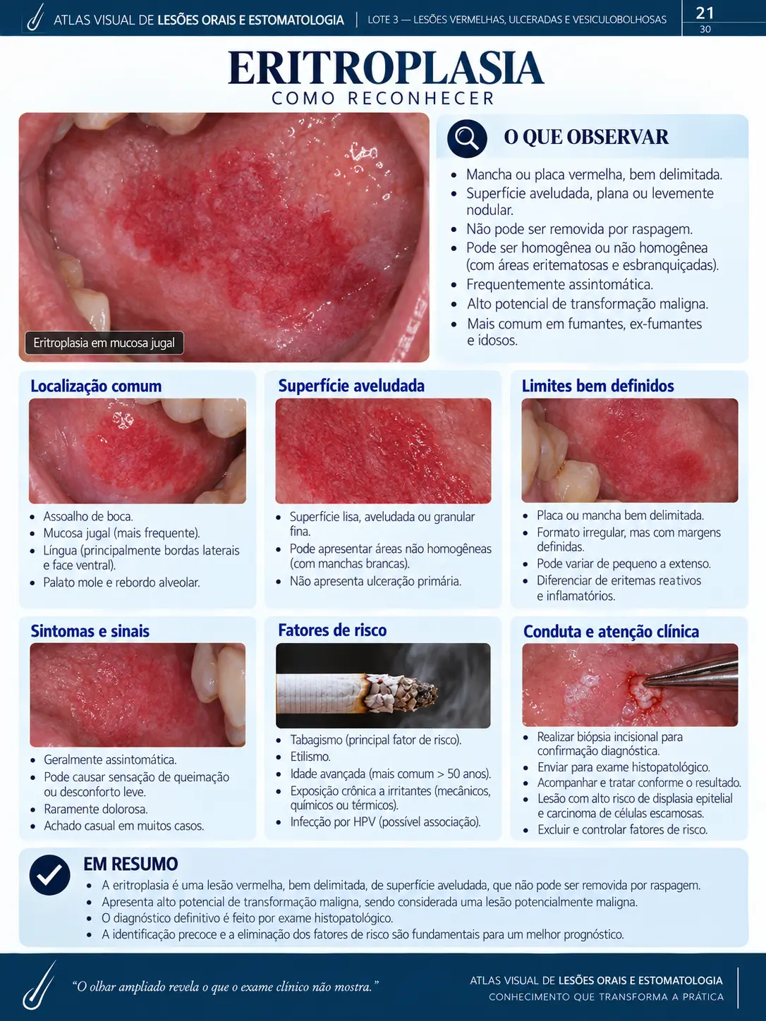 Página do ORALMAP: Leucoplasia