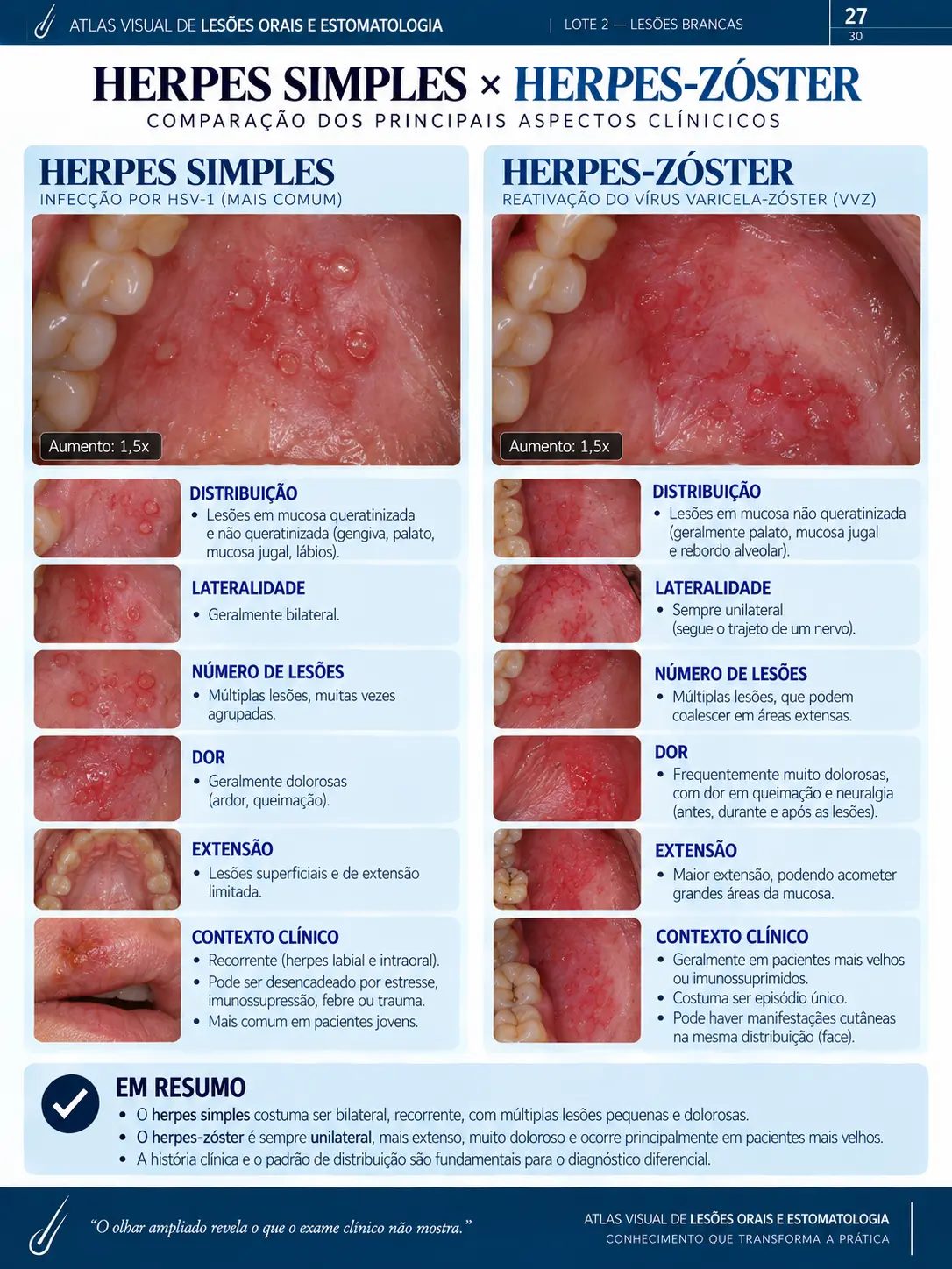 Página do ORALMAP: Mucocele