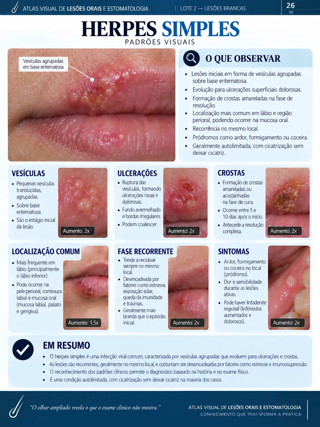Página do ORALMAP: Herpes Oral