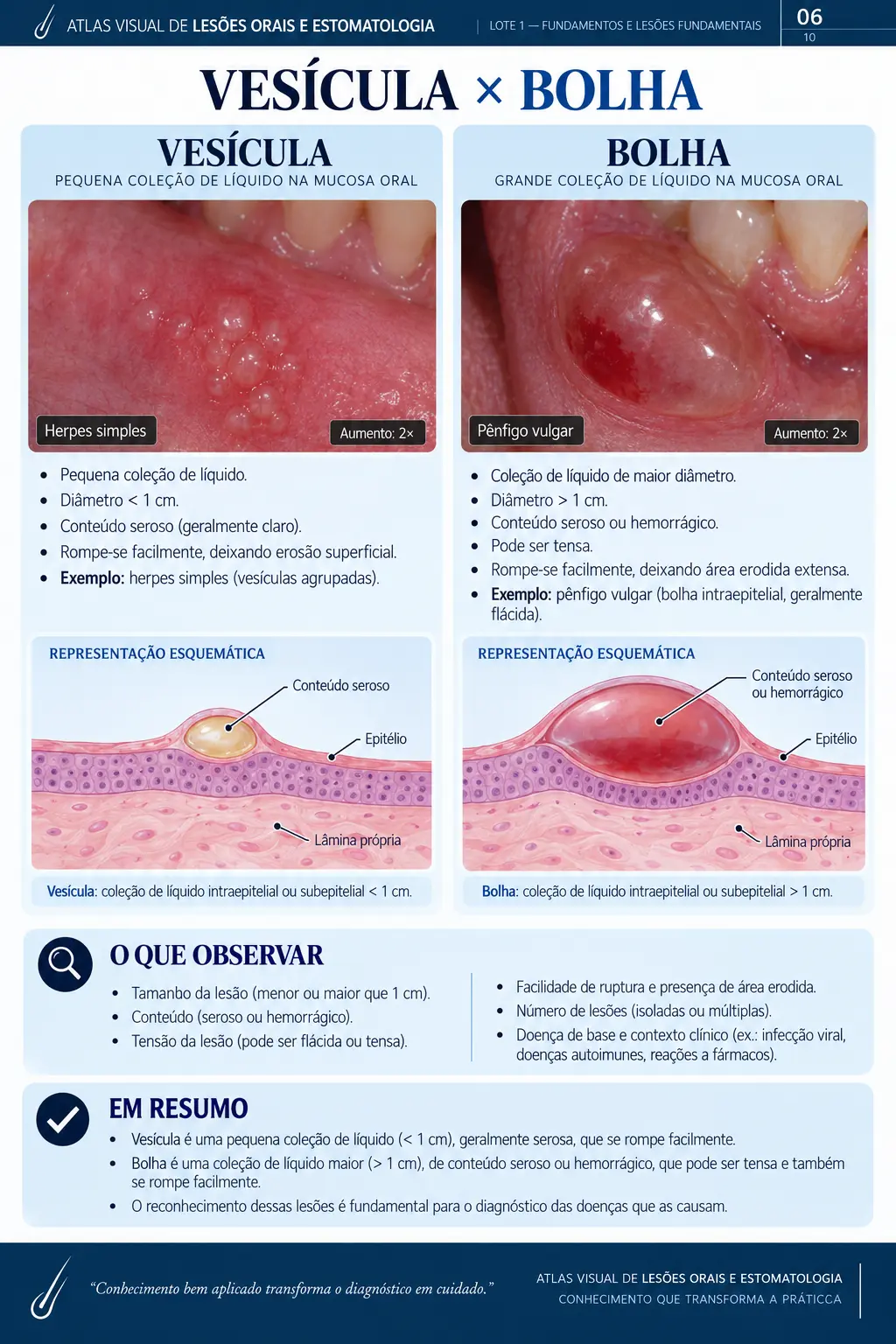 Página do ORALMAP: Afta × Herpes Oral