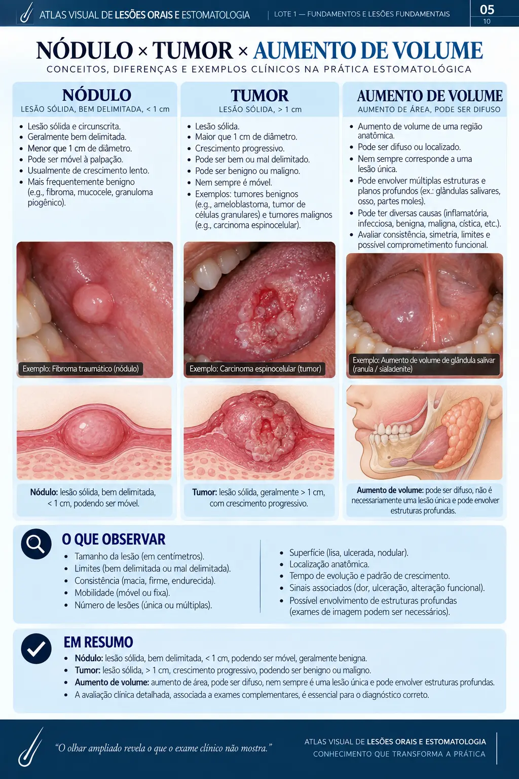 Página do ORALMAP: Candidíase Pseudomembranosa × Leucoplasia