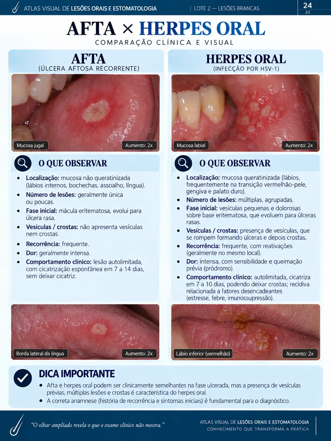 Página do ORALMAP: Candidíase